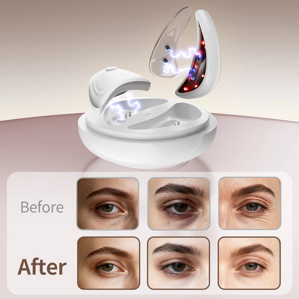 Apply the gel pads