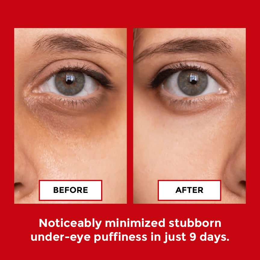 PulseGlow before and after